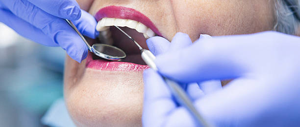 Best Broken or Cracked Tooth Emergency Dentist in Kensington, MD